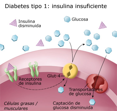 雷竞技raybet-com糖尿病提示1：胰岛素不足