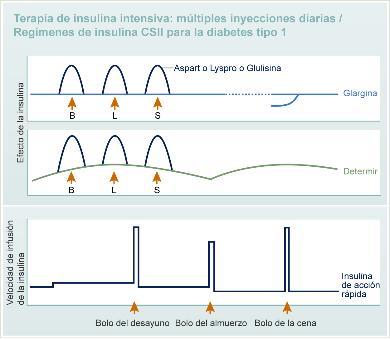 Terapia Intensiva de Insulina：Cuadro de efecto de la Insulina