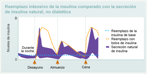 Reemplazo de Insulina Intensivo，Coramado con la la lasecreciónde Insulina Natural，无糖尿病